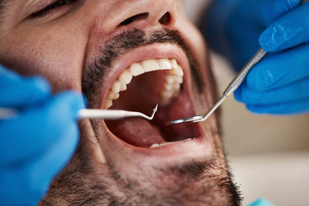 Emergency Dentist Open Today in SD